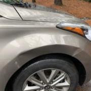 Hyundai Elantra Carmedic Big Dent Repair