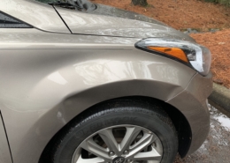 Hyundai Elantra Carmedic Big Dent Repair