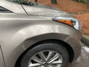 Hyundai Elantra Carmedic Big Dent Repair