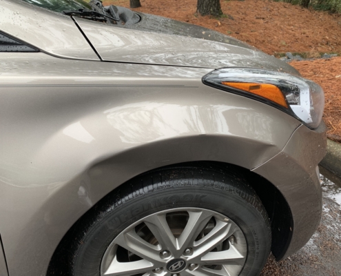 Hyundai Elantra Carmedic Big Dent Repair